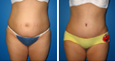 Before & After Photos